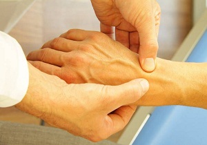 полиартрит рук