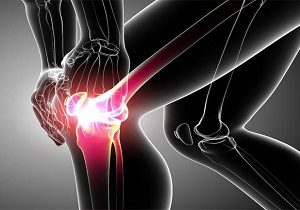 хондромаляция коленного сустава что это такое