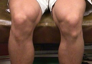 болезнь шляттера лечение