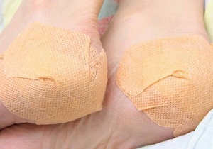 близкофокусная рентгенотерапия