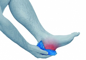 шпора на пятке симптомы и лечение