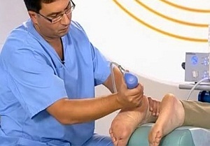 рентгенотерапия тяточной шпоры отзывы