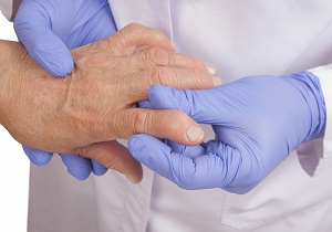 ревматический полиартрит