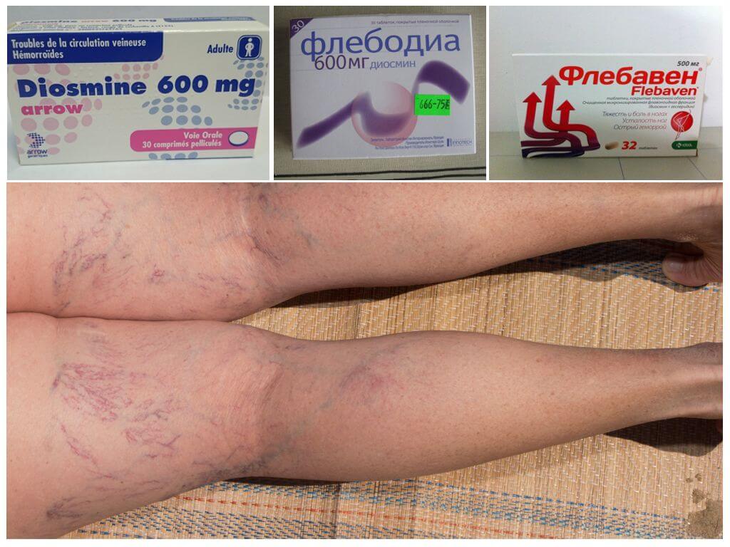 Аналоги Венаруса