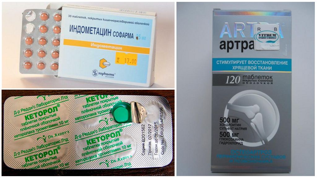 Медикаменты для лечения артроза