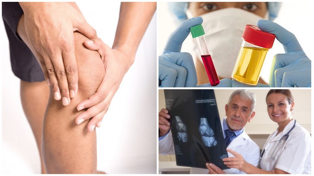 Диагностика для лечения артрозо артрита суставов