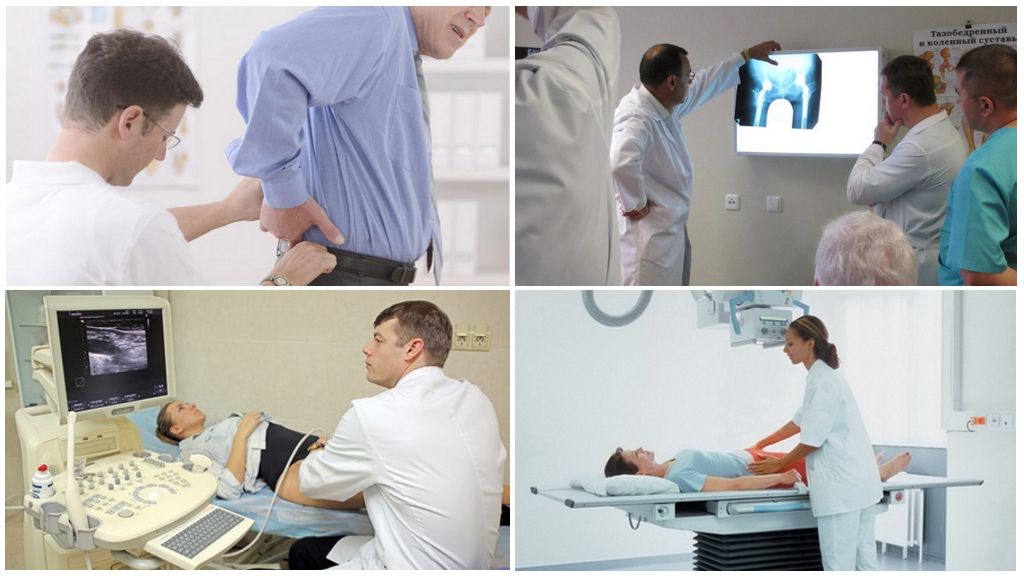 Диагностика артроза