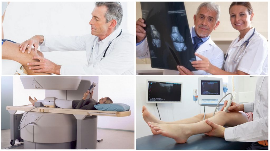 Диагностика серопозитивного ревматоидного артрита