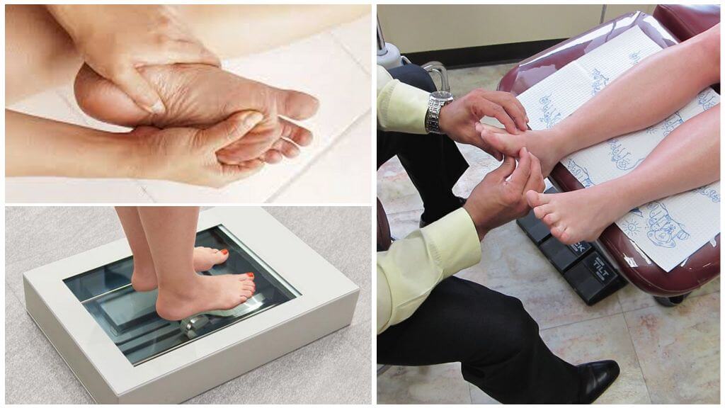 Диагностика пяточной шпоры