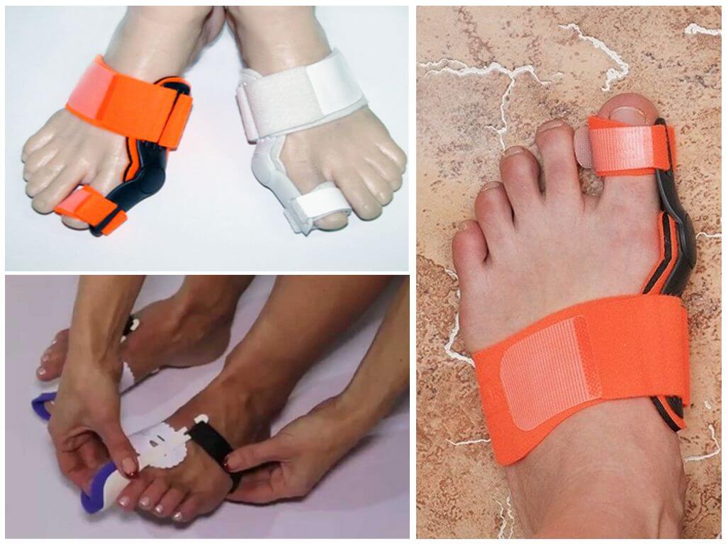 Ортопедические приспособления от шишек на ногах