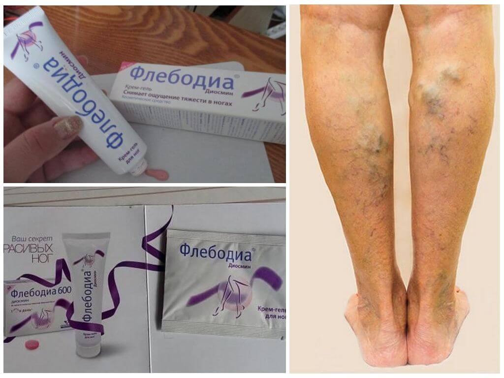 Крем-гель для ног от варикоза Флебодиа