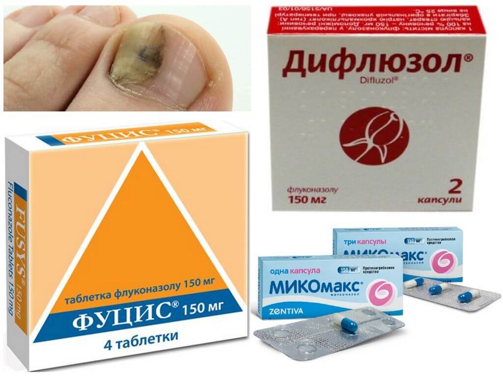 Аналоги Флуконазола