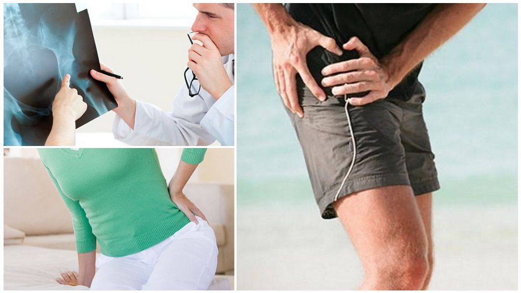 Инвалидность при коксартрозе тазобедренного сустава