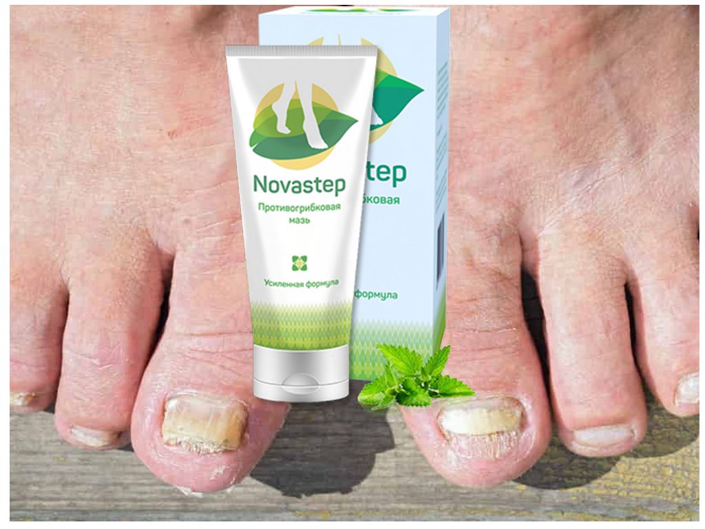 Novastep от грибка ногтей
