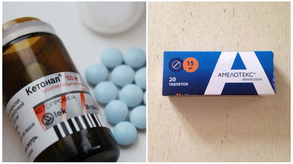 Препараты для лечения артроза