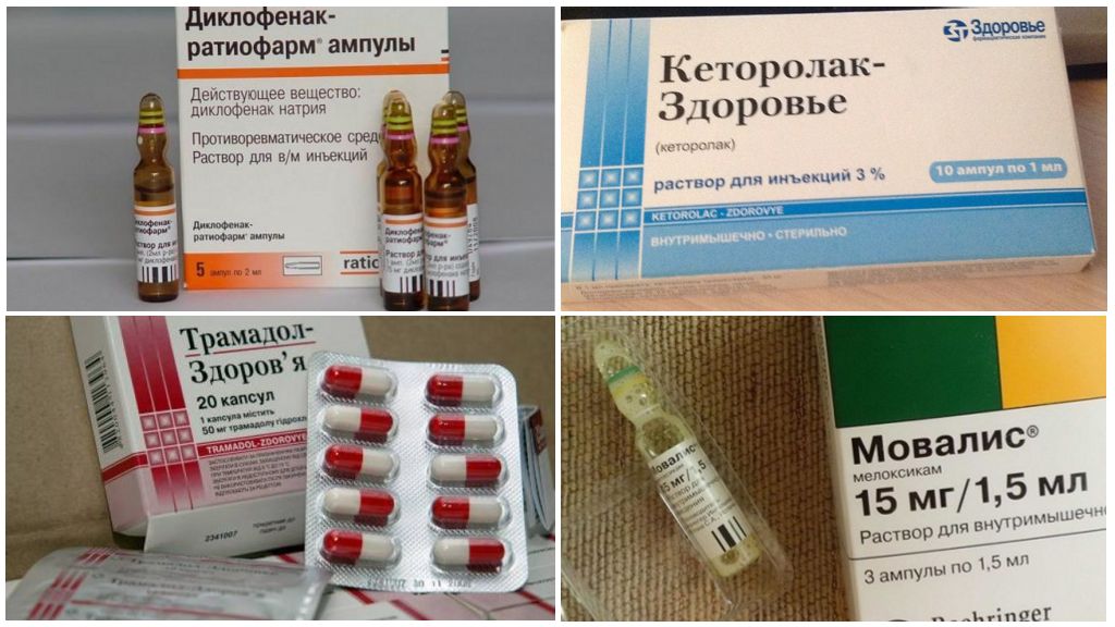 Препараты для лечения артроза тазобедренного сустава