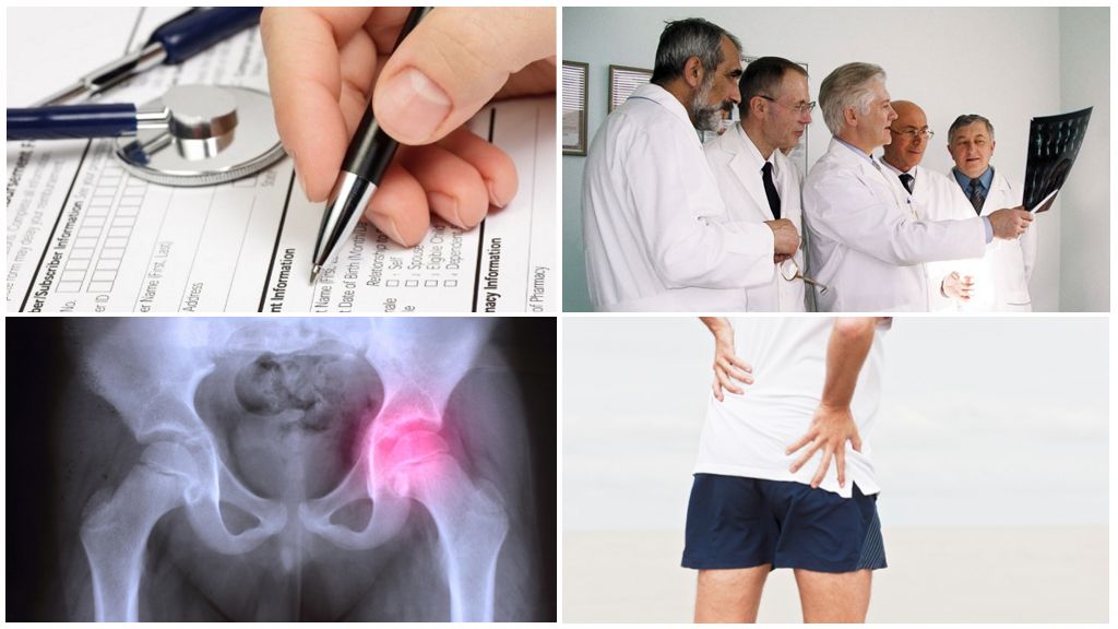 Получение инвалидности при коксартрозе тазобедренного сустава