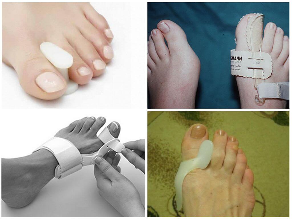 Фиксаторы для большого пальца ноги
