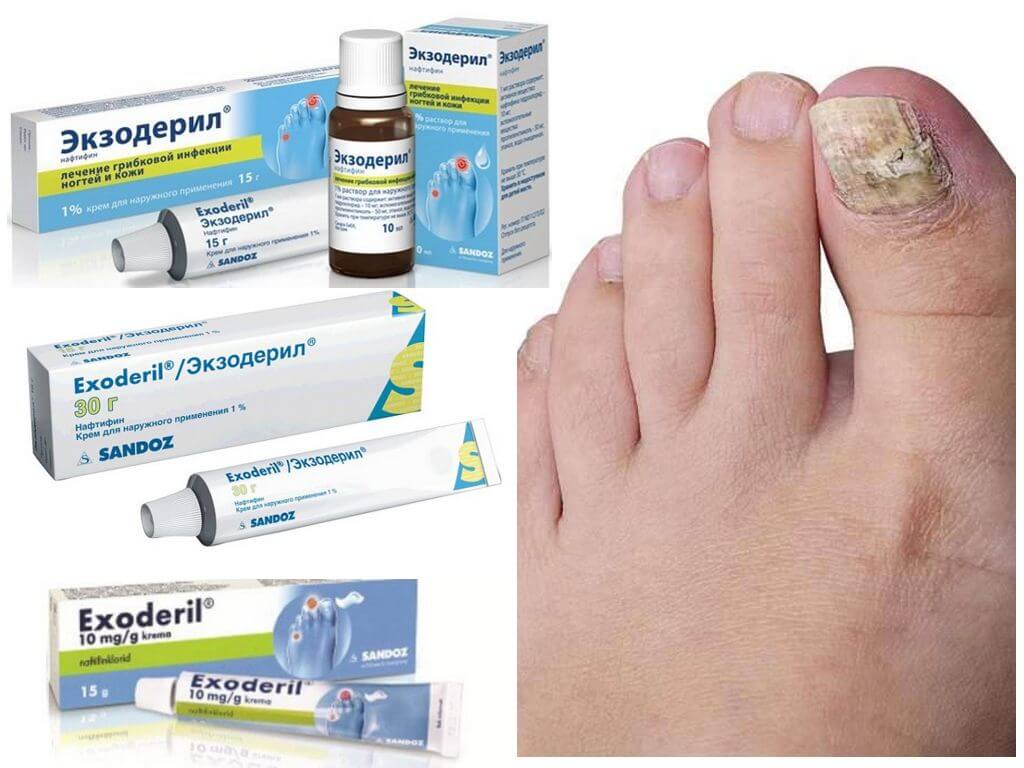 Крем Экзодерил от грибка ногтей