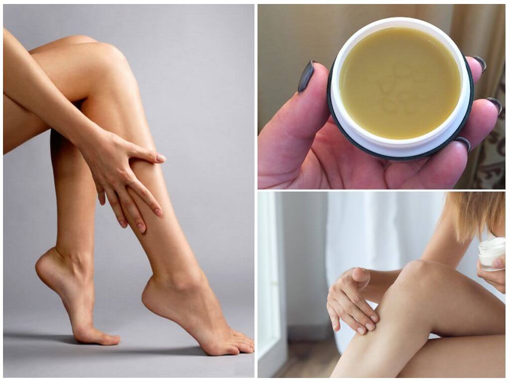 Применение крем-воск Здоров при варикозе на ногах