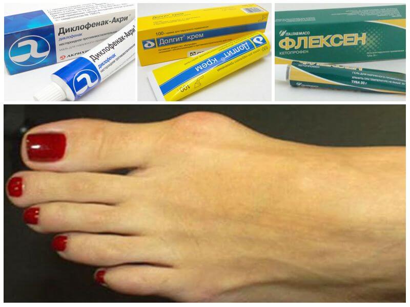 Наружные средства при вальгусном искривлении стопы