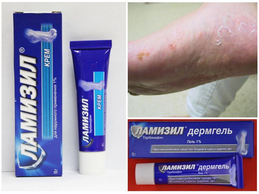 Ламизил от микоза стопы