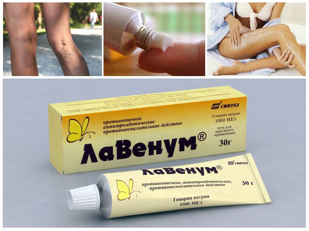 Использование геля Лавенум при варикозе