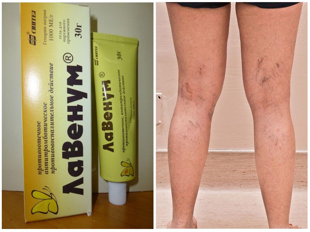 Гель Лавенум от варикоза