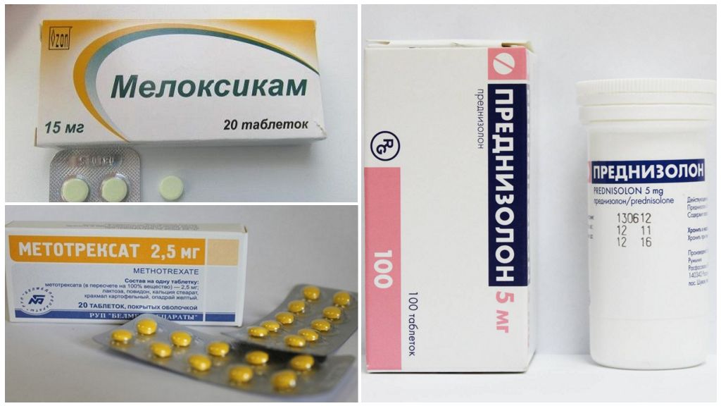 Препараты для лечения артрозо артрита суставов