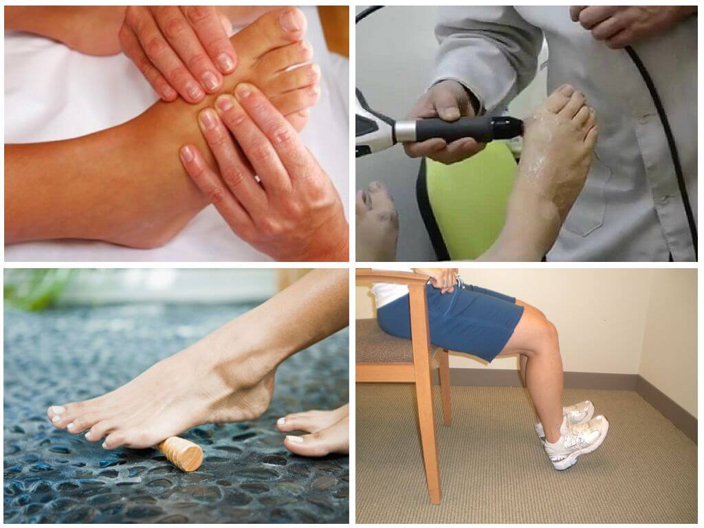 Лечение косточек на ногах