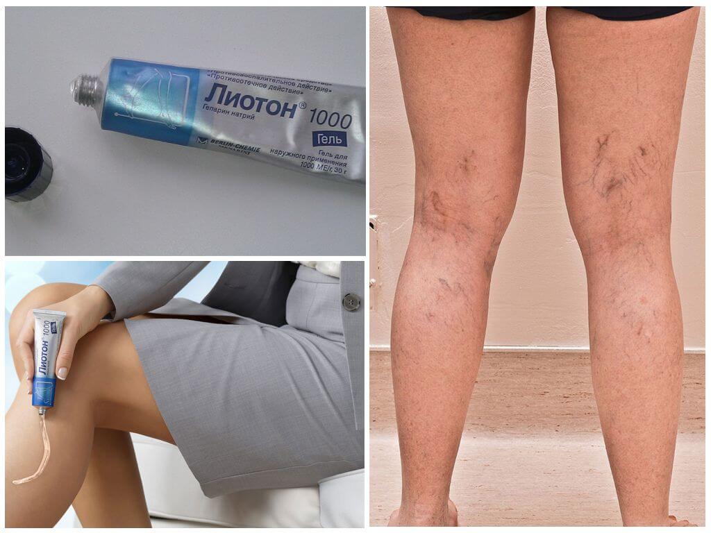 Применение геля Лиотон 1000
