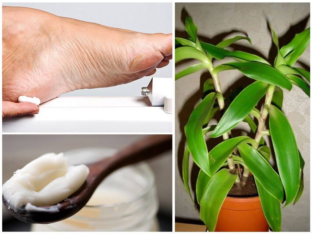 Домашняя мазь для лечения пяточной шпоры