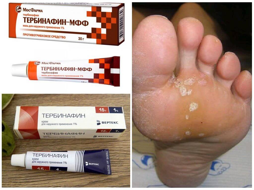 Крем и мазь Тербинафин от грибка