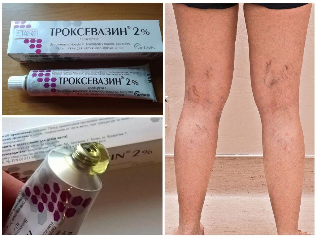 Гель Троксевазин от варикозного расширения вен