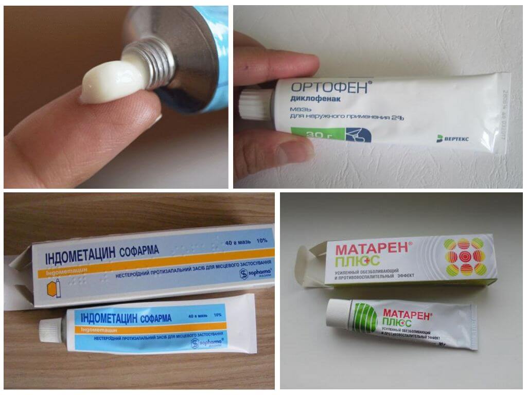 Мази от шишек на ногах у большого пальца