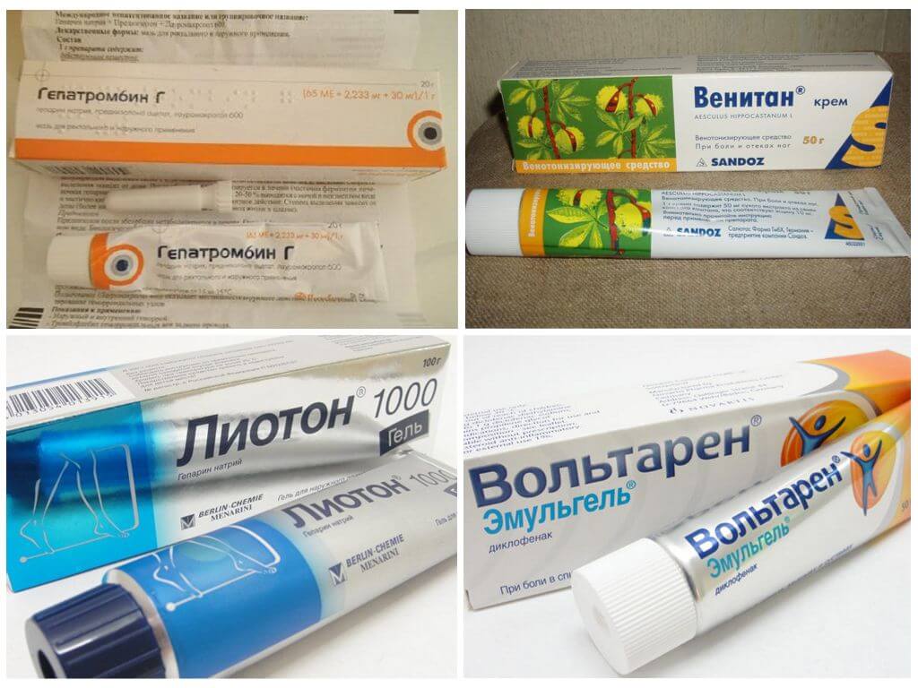Наружные препараты для лечения варикоза