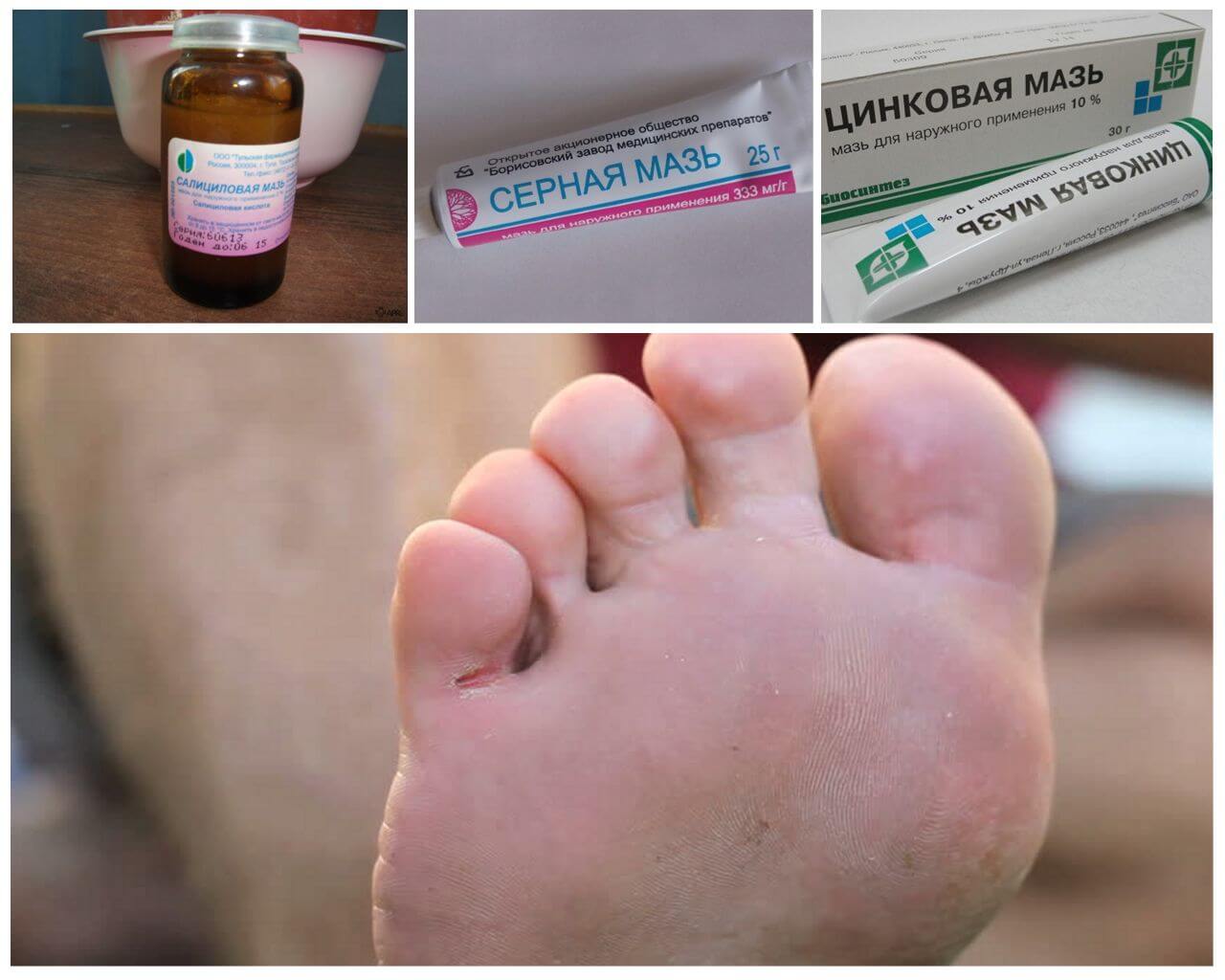Неспецифические мази против грибка