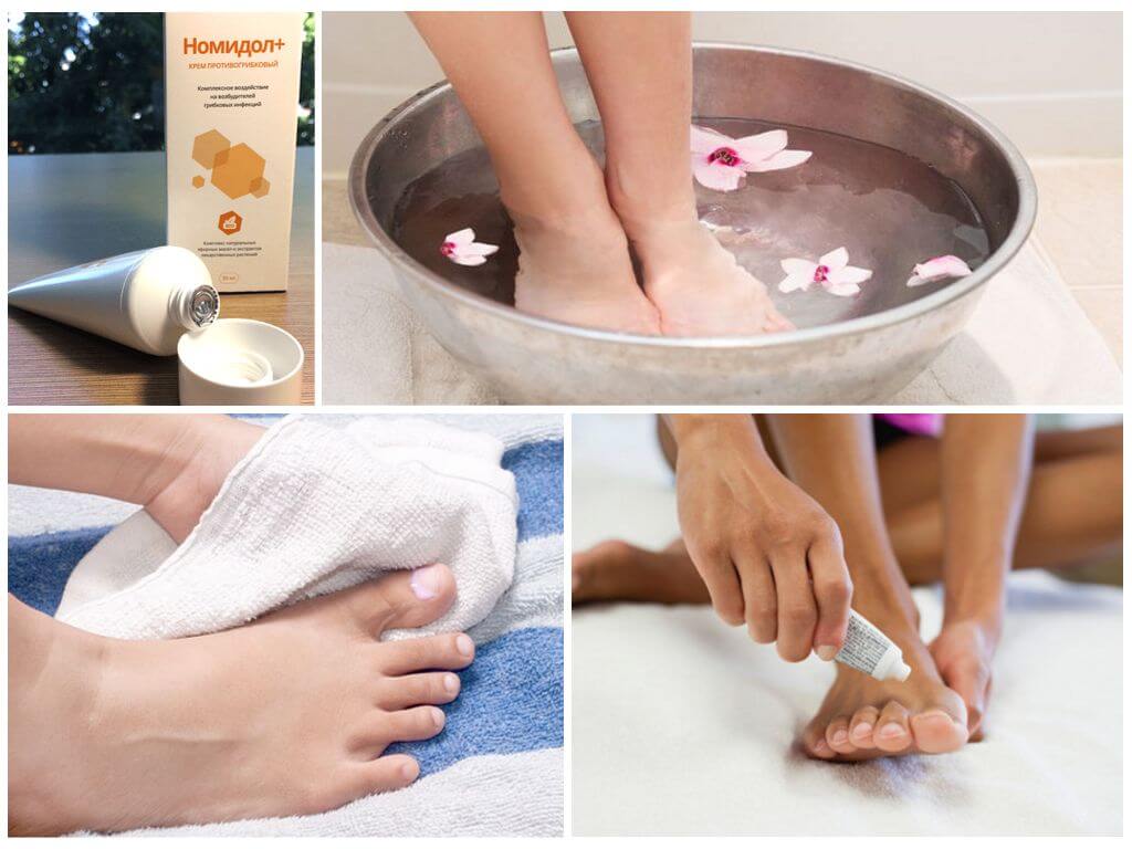 Применение крема Номидол