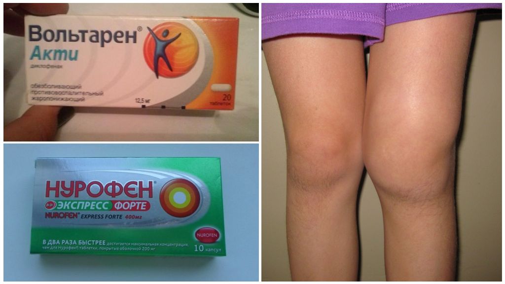 Препараты для лечения артроза