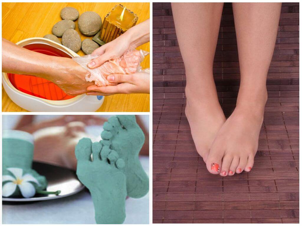 Обертывания для лечения косточек на ногах