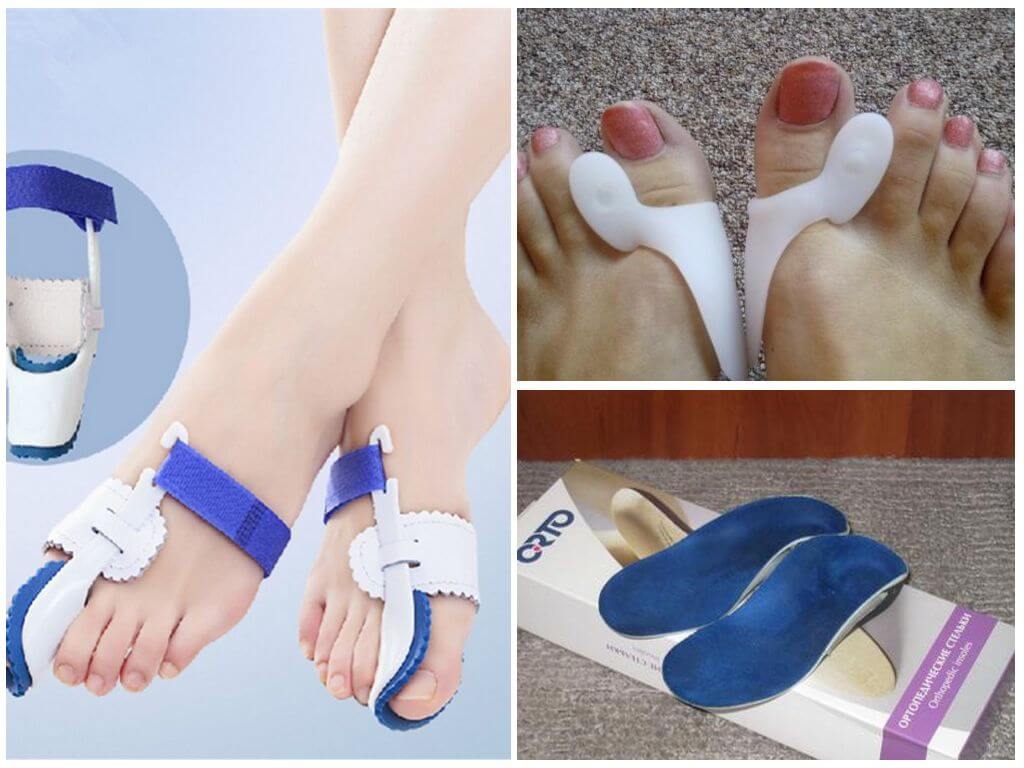 Ортопедические приспособления для косточки на ноге у большого пальца