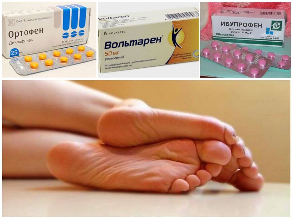 Медикаментозная терапия пяточной шпоры