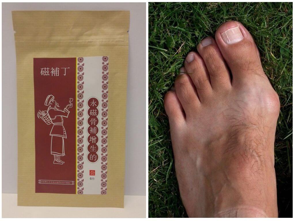 Китайский магнитный пластырь Hyperosteogeny от косточек на ногах