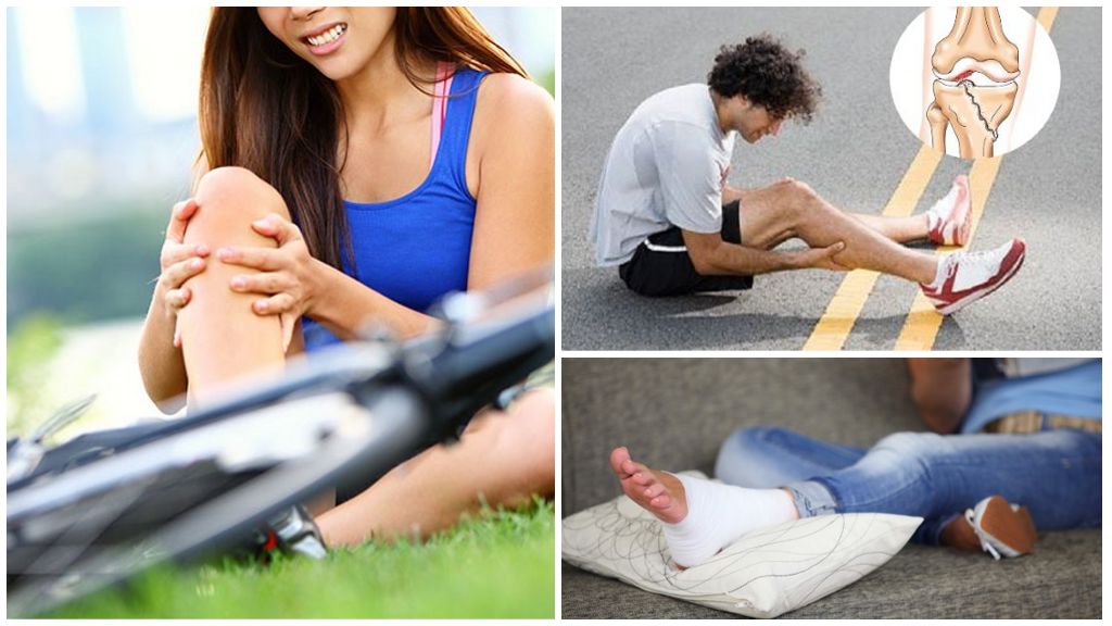 Посттравматический артроз