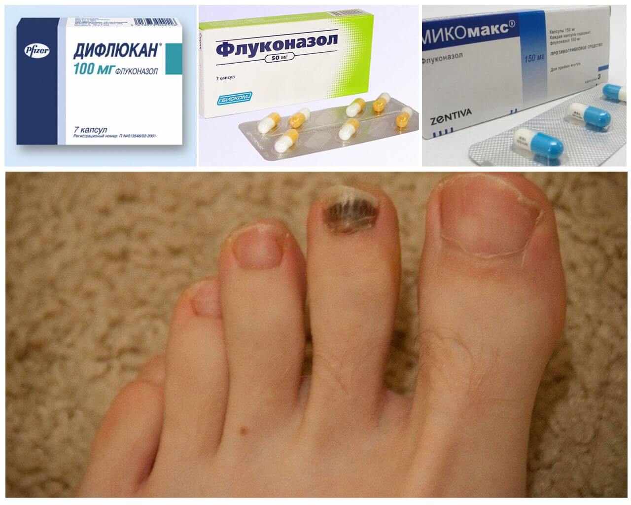 Препараты на основе флуконазола