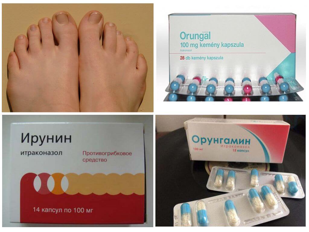 Средства от грибка с итраконазолом