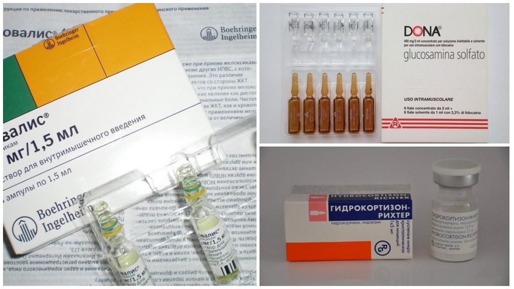 Препараты для лечения коксартроза тазобедренного сустава