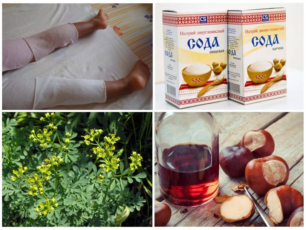 Народные средства от варикоза