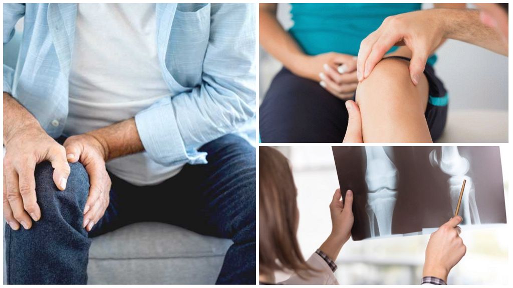 Серопозитивный ревматоидный артрит