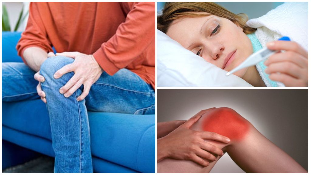 Симптомы пателлофеморального артроза